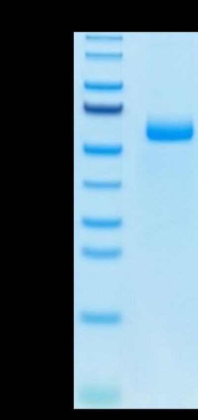 Mouse Adiponectin on Tris-Bis PAGE under reduced condition. The purity is greater than 95%.Recombinant Mouse Adiponectin/Acrp30 Protein