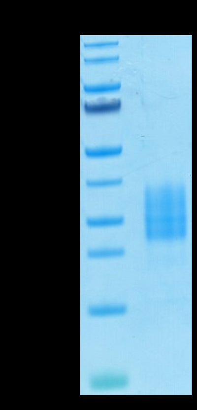 Biotinylated Human NKp30 on Tris-Bis PAGE under reduced condition. The purity is greater than 95%.Biotinylated Human NKp30/NCR3/CD337 Protein, Active