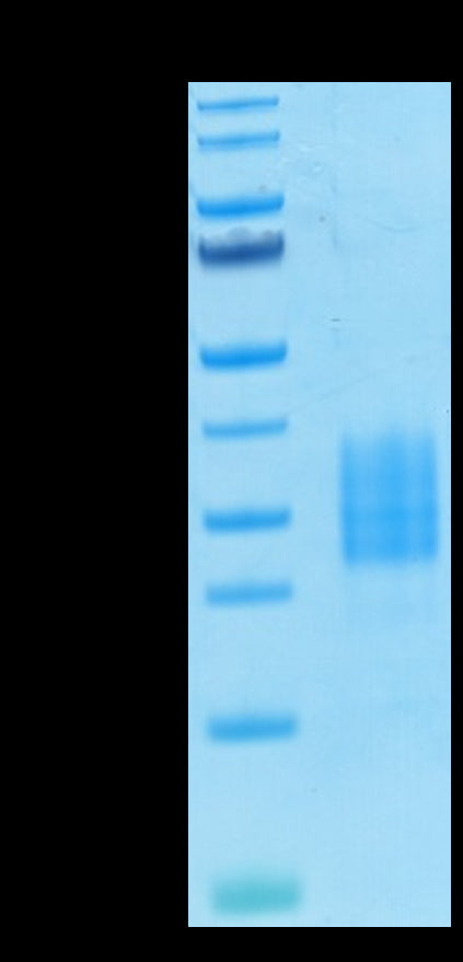 Biotinylated Human NKp30 on Tris-Bis PAGE under reduced condition. The purity is greater than 95%.Biotinylated Human NKp30/NCR3/CD337 Protein, Active