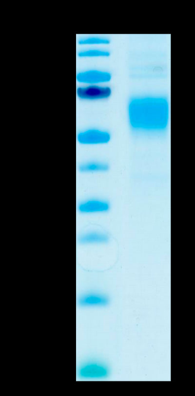 Human Fc gamma RI on Tris-Bis PAGE under reduced condition. The purity is greater than 95%.Recombinant Human Fc gamma RI/CD64 Protein, Active