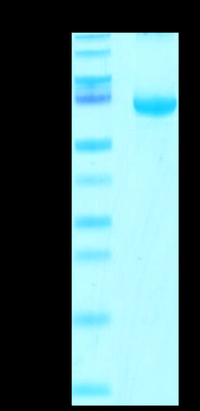 Cynomolgus FGL1 on Tris-Bis PAGE under reduced condition. The purity is greater than 95%.Recombinant Cynomolgus FGL1 Protein, Active