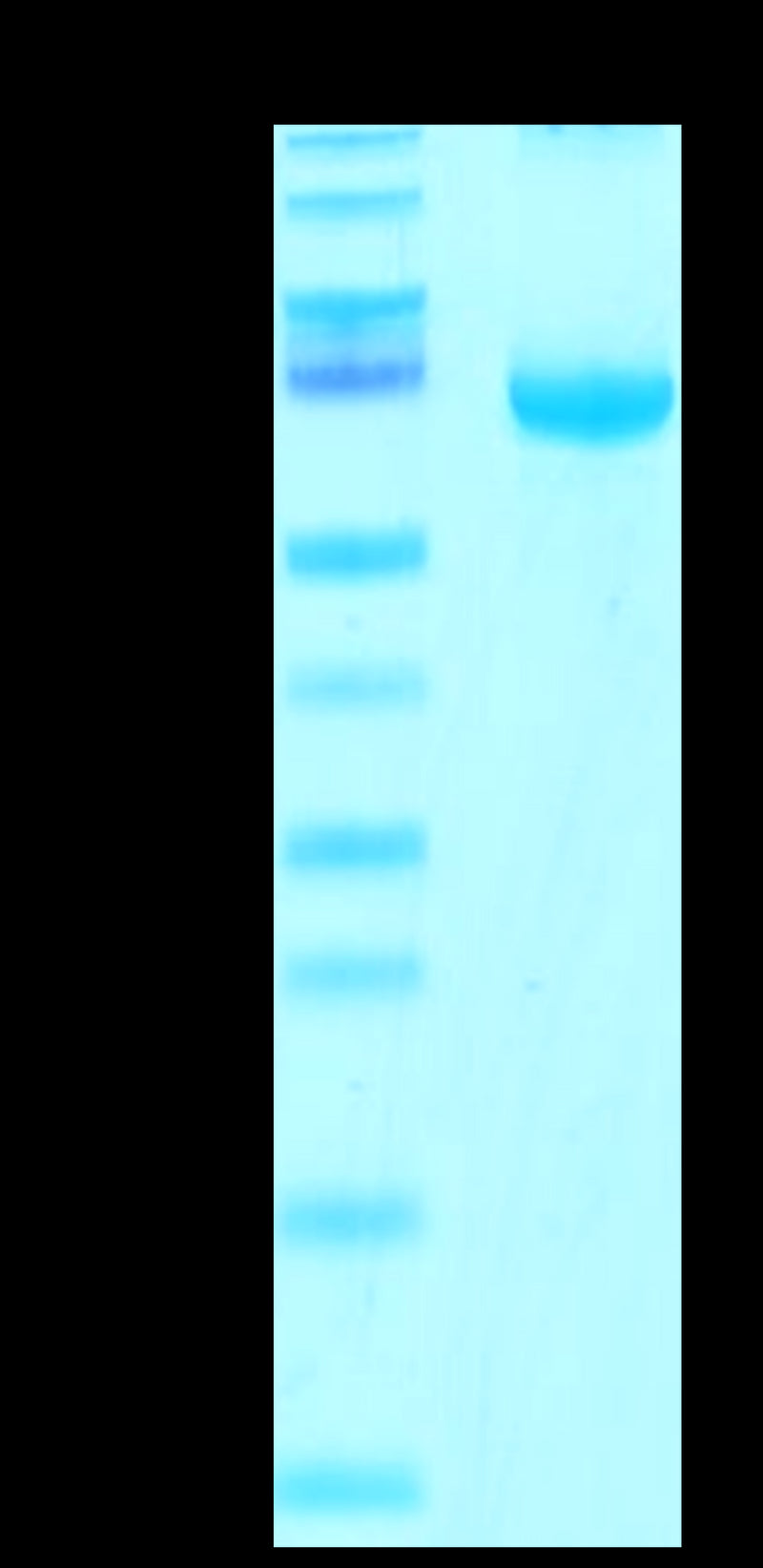 Cynomolgus FGL1 on Tris-Bis PAGE under reduced condition. The purity is greater than 95%.Recombinant Cynomolgus FGL1 Protein, Active