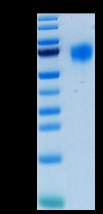 Human FGFR4 on Tris-Bis PAGE under reduced condition. The purity is greater than 95%.Recombinant Human FGFR4 Protein