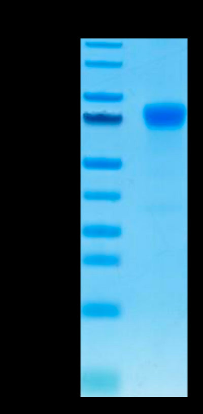 Human PD-L1 on Tris-Bis PAGE under reduced condition. The purity is greater than 95%.Recombinant Human PD-L1/B7-H1 Protein, Active