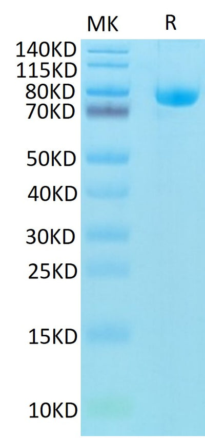 Biotinylated Human CD5 on Tris-Bis PAGE under reduced condition. The purity is greater than 95%.Biotinylated Human CD5 Protein, Active