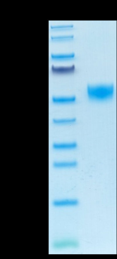Mouse CD5 on Tris-Bis PAGE under reduced condition. The purity is greater than 95%.Recombinant Mouse CD5 Protein