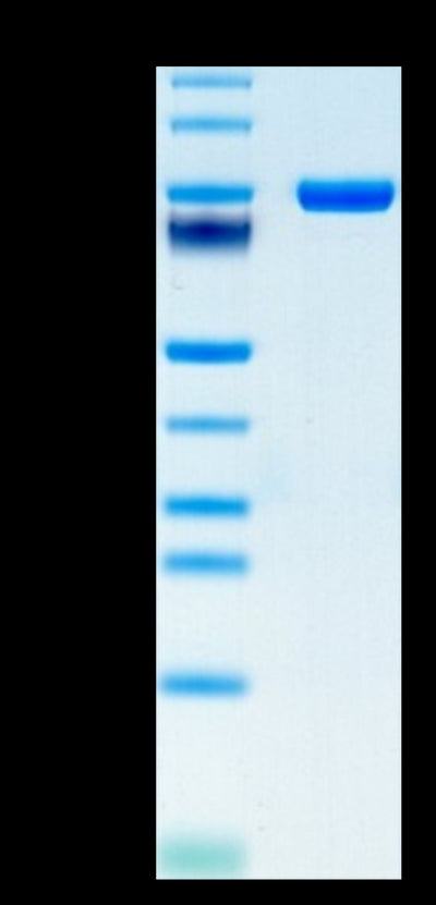 Human CD5 on Tris-Bis PAGE under reduced condition. The purity is greater than 95%.Recombinant Human CD5 Protein, Active