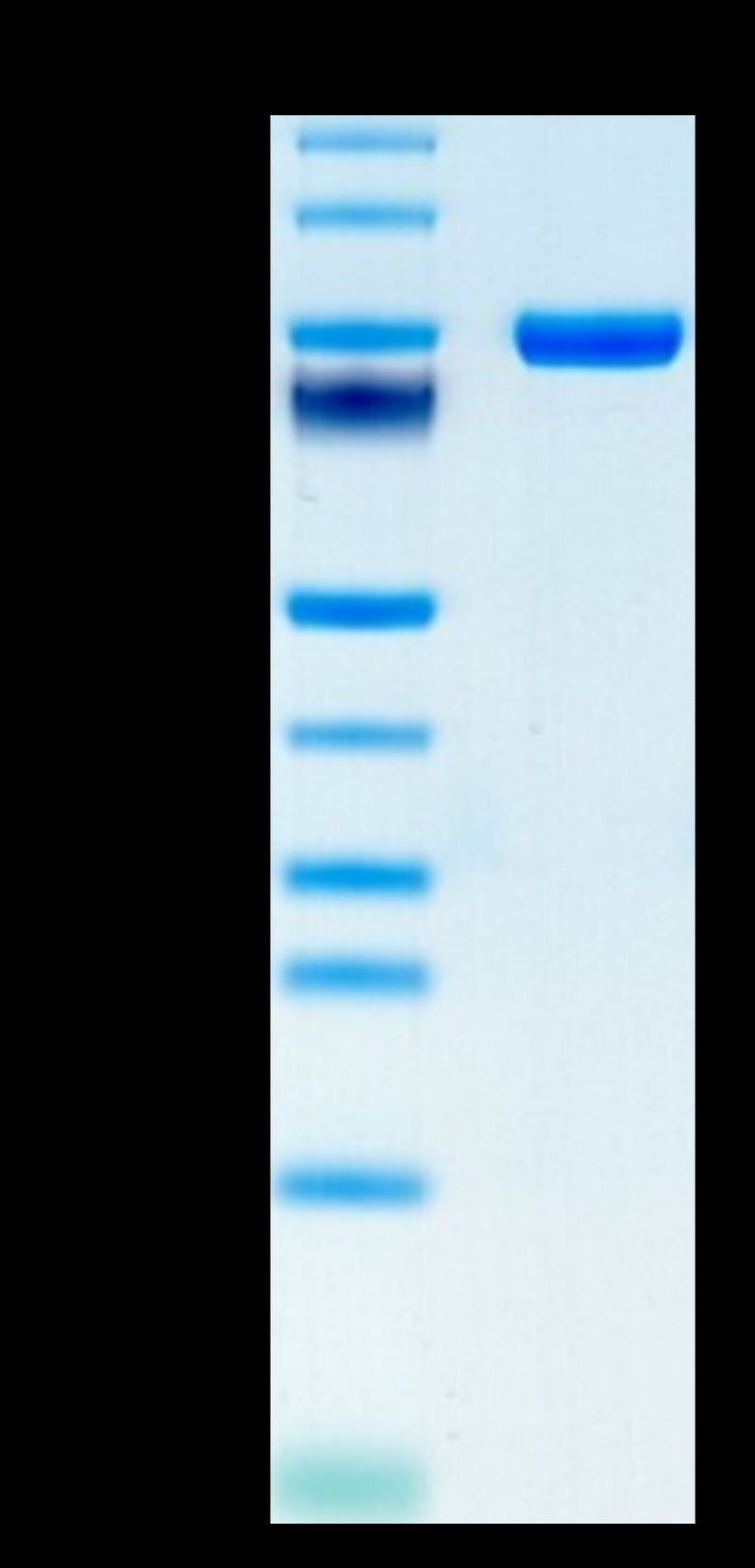 Human CD5 on Tris-Bis PAGE under reduced condition. The purity is greater than 95%.Recombinant Human CD5 Protein, Active