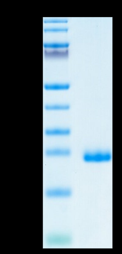Human TIMP-2 on Tris-Bis PAGE under reduced condition. The purity is greater than 95%.Recombinant Human TIMP-2 Protein, Active
