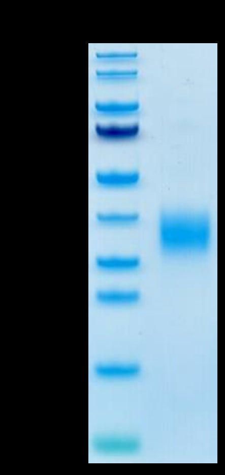 Mouse LAIR1 on Tris-Bis PAGE under reduced conditions. The purity is greater than 95%.Recombinant Mouse LAIR1/CD305 Protein