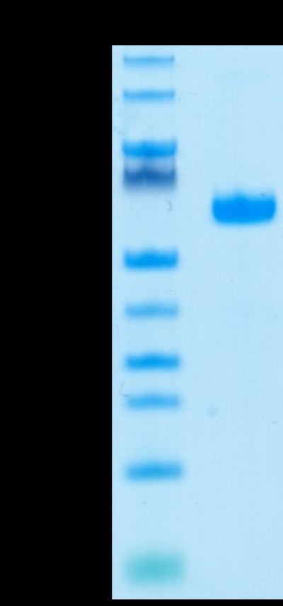 Human LAIR1 on Tris-Bis PAGE under reduced conditions. The purity is greater than 95%.Recombinant Human LAIR1/CD305 Protein, Active