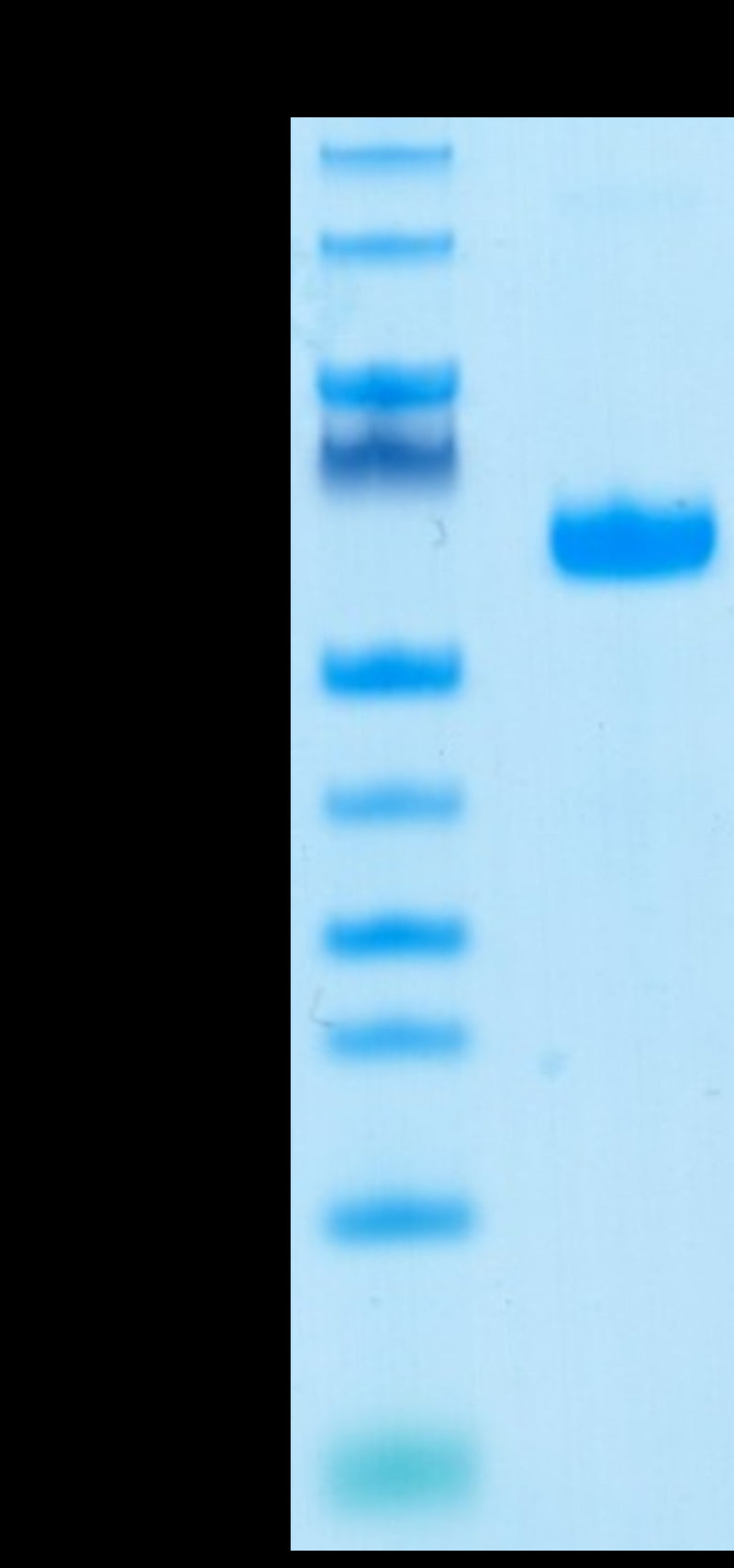 Human LAIR1 on Tris-Bis PAGE under reduced conditions. The purity is greater than 95%.Recombinant Human LAIR1/CD305 Protein, Active