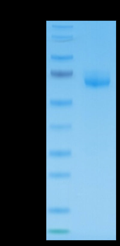 Human LILRB4 on Tris-Bis PAGE under reduced condition. The purity is greater than 95%.Recombinant Human LILRB4/CD85k/ILT3 Protein, Active