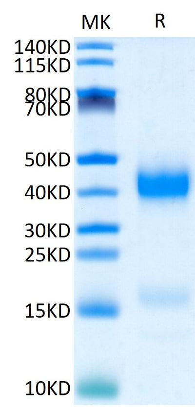 Human Azurocidin on Tris-Bis PAGE under reduced condition. The purity is greater than 95%.Recombinant Human Azurocidin/CAP37/AZU1/HBP Protein