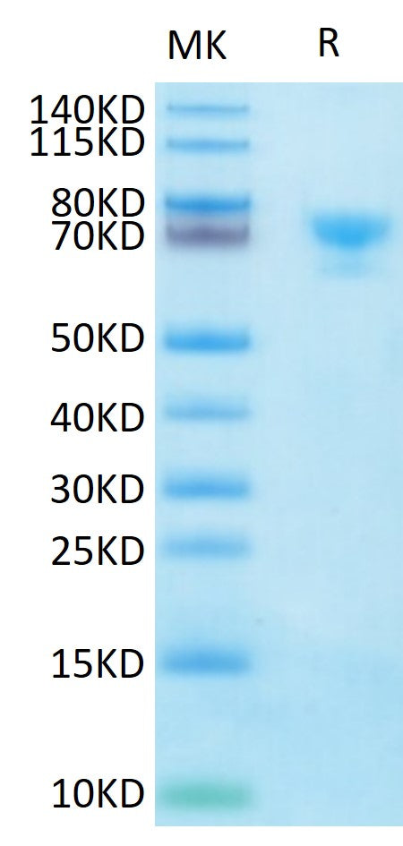 Biotinylated Human MSLN on Tris-Bis PAGE under reduced condition. The purity is greater than 95%.Biotinylated Human MSLN/Mesothelin Protein, Active
