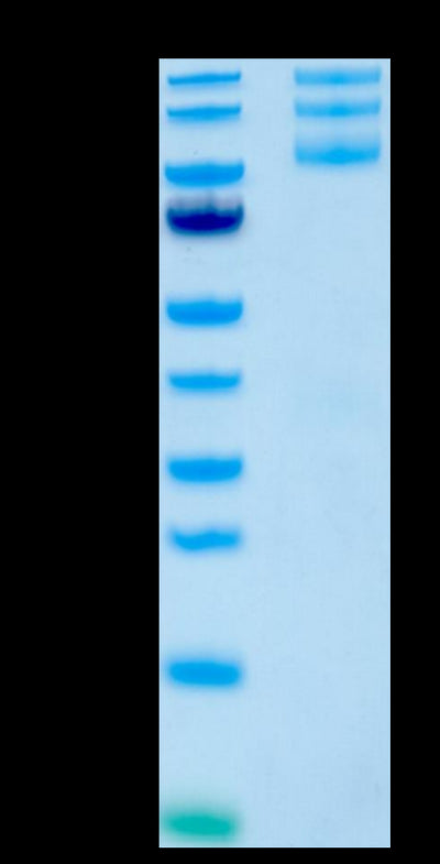 Human ITGAV&ITGB5-on Tris-Bis PAGE under reduced conditions. The purity is greater than 95%.Recombinant Human Integrin alpha V beta 5 (ITGAV&ITGB5) Heterodimer Protein, Active