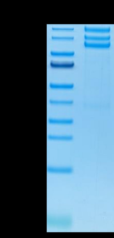 Human ITGAV&ITGB3 on Tris-Bis PAGE under reduced conditions. The purity is greater than 95%.Recombinant Human Integrin alpha V beta 3 (ITGAV&ITGB3) Heterodimer Protein, Active