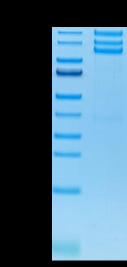 Human ITGAV&ITGB3 on Tris-Bis PAGE under reduced conditions. The purity is greater than 95%.Recombinant Human Integrin alpha V beta 3 (ITGAV&ITGB3) Heterodimer Protein, Active