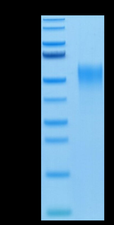 Mouse CD24 on Tris-Bis PAGE under reduced condition. The purity is greater than 95%.Recombinant Mouse CD24 Protein
