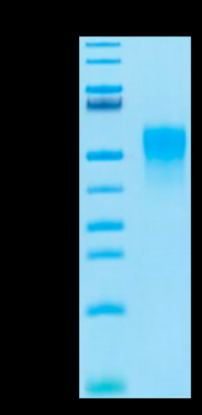 Cynomolgus TNFR2 on Tris-Bis PAGE under reduced condition. The purity is greater than 95%.Recombinant Cynomolgus TNFR2/CD120b/TNFRSF1B Protein, Active