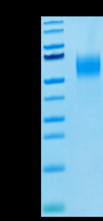 Biotinylated Human Nectin-1 on Tris-Bis PAGE under reduced condition. The purity is greater than 95%.Biotinylated Human Nectin-1/PVRL1/CD111 Protein, Active
