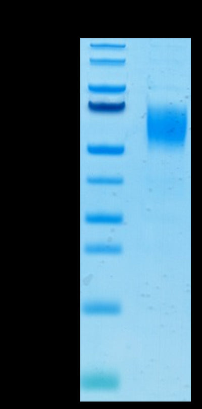 Human Nectin-1 on Tris-Bis PAGE under reduced condition. The purity is greater than 95%.Recombinant Human Nectin-1/PVRL1/CD111 Protein, Active