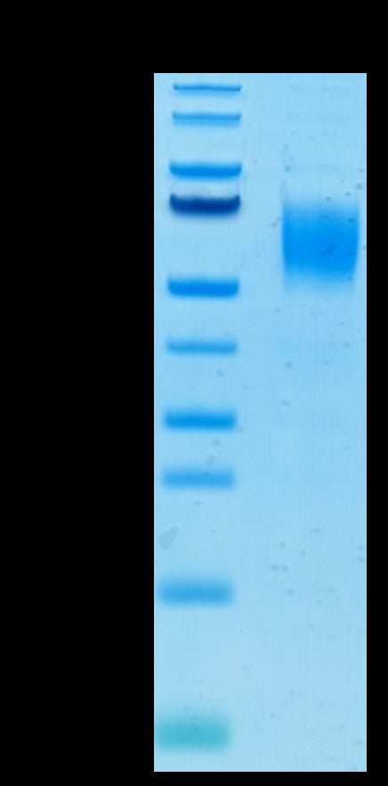 Human Nectin-1 on Tris-Bis PAGE under reduced condition. The purity is greater than 95%.Recombinant Human Nectin-1/PVRL1/CD111 Protein, Active