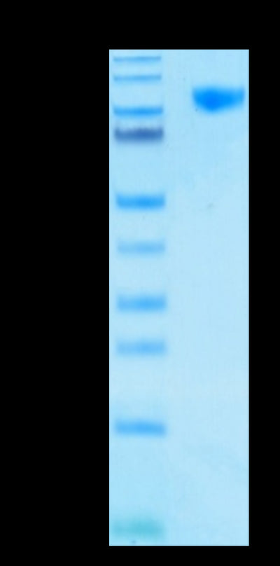 Human Siglec-9 on Tris-Bis PAGE under reduced condition. The purity is greater than 95%.Recombinant Human Siglec-9 Protein