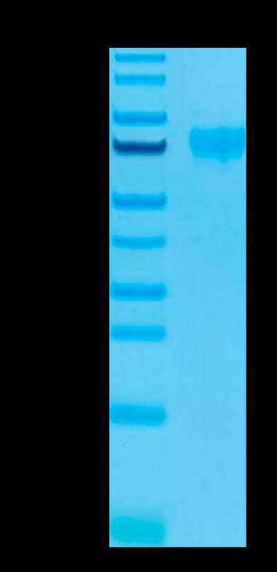 Human Siglec-9 on Tris-Bis PAGE under reduced condition. The purity is greater than 95%.Recombinant Human Siglec-9 Protein