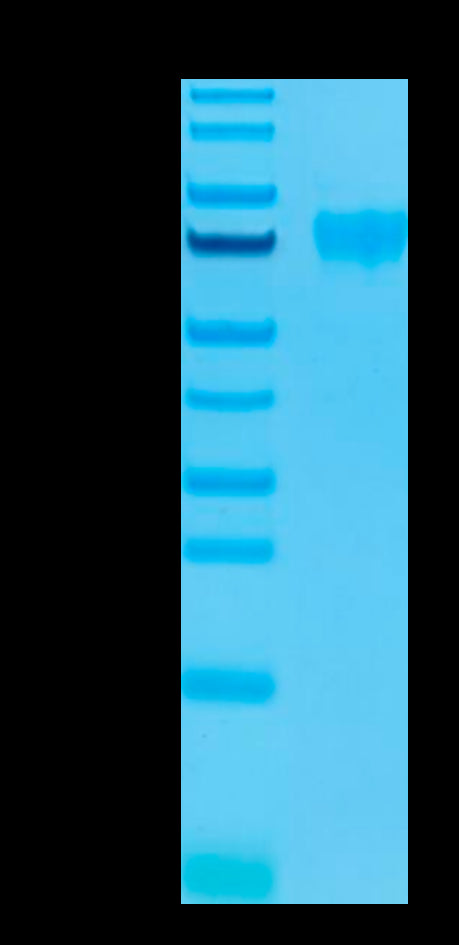 Human Siglec-9 on Tris-Bis PAGE under reduced condition. The purity is greater than 95%.Recombinant Human Siglec-9 Protein