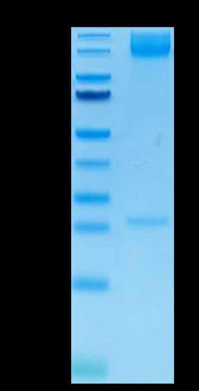 Human ITGA5&ITGB1 on Tris-Bis PAGE under reduced condition. The purity is greater than 95%.Recombinant Human Integrin alpha 5 beta 1 (ITGA5&ITGB1) Heterodimer Protein, Active