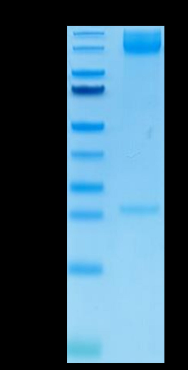 Human ITGA5&ITGB1 on Tris-Bis PAGE under reduced condition. The purity is greater than 95%.Recombinant Human Integrin alpha 5 beta 1 (ITGA5&ITGB1) Heterodimer Protein, Active