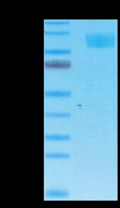 Cynomolgus ACE2 on Tris-Bis PAGE under reduced condition. The purity is greater than 95%.Recombinant Cynomolgus ACE2/ACEH Protein, Active