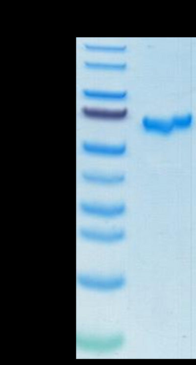 SARS-COV-2 Spike RBD on Tris-Bis PAGE under reduced condition. The purity is greater than 95%.Recombinant SARS-COV-2 Spike RBD Protein, Active