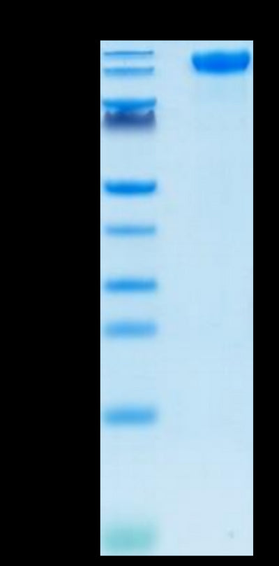 SARS-COV-2 Spike S1 on Tris-Bis PAGE under reduced condition. The purity is greater than 95%.Recombinant SARS-COV-2 Spike S1 Protein, Active