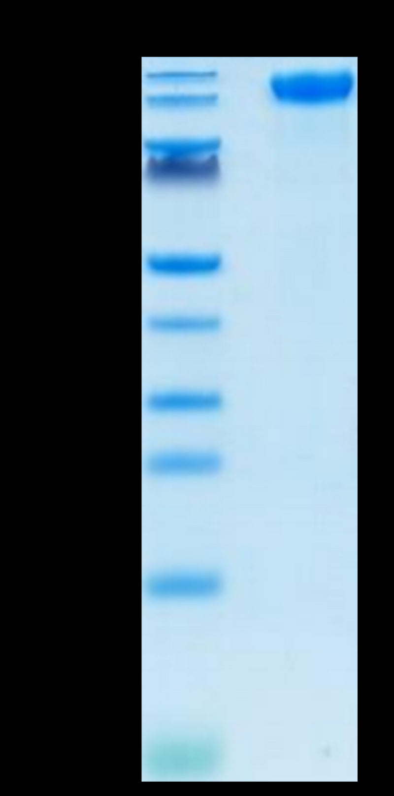SARS-COV-2 Spike S1 on Tris-Bis PAGE under reduced condition. The purity is greater than 95%.Recombinant SARS-COV-2 Spike S1 Protein, Active