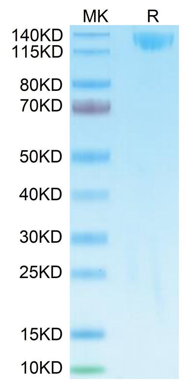 Biotinylated SARS spike S1 on Tris-Bis PAGE under reduced condition. The purity is greater than 95%.Biotinylated SARS Spike S1 Protein