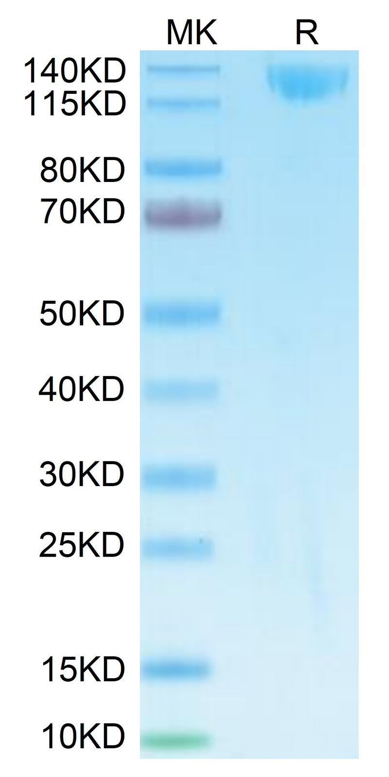 Biotinylated SARS spike S1 on Tris-Bis PAGE under reduced condition. The purity is greater than 95%.Biotinylated SARS Spike S1 Protein