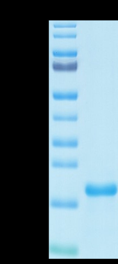 SARS-COV-2 NP NTD Domain on Tris-Bis PAGE under reduced condition. The purity is greater than 95%.Recombinant SARS-COV-2 Nucleocapsid Protein NTD Domain Protein