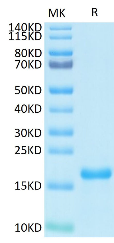 Biotinylated SARS-COV-2 NP NTD Domain on Tris-Bis PAGE under reduced condition. The purity is greater than 95%.Biotinylated SARS-COV-2 Nucleocapsid Protein NTD Domain Protein