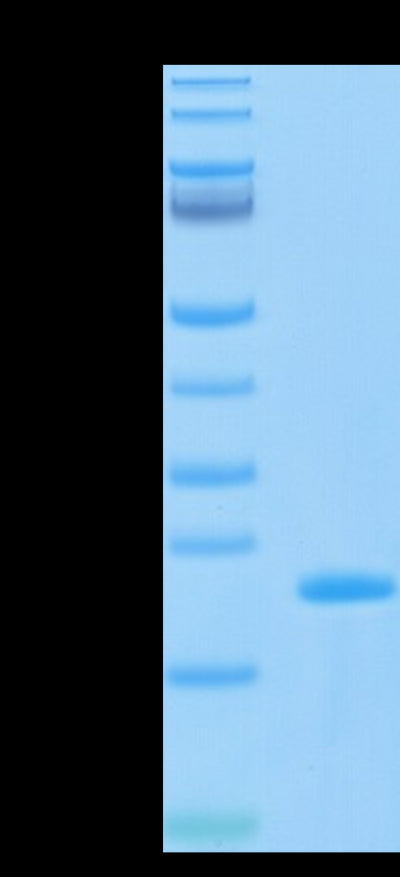 Biotinylated SARS-COV-2 Nucleocapsid CTD Domain on Tris-Bis PAGE under reduced condition. The purity is greater than 95%.Biotinylated SARS-COV-2 Nucleocapsid Protein CTD Domain Protein