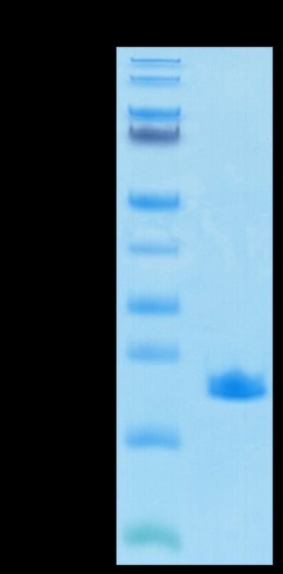 SARS-COV-2 NP CTD Domain on Tris-Bis PAGE under reduced condition. The purity is greater than 95%.Recombinant SARS-COV-2 Nucleocapsid Protein CTD Domain Protein