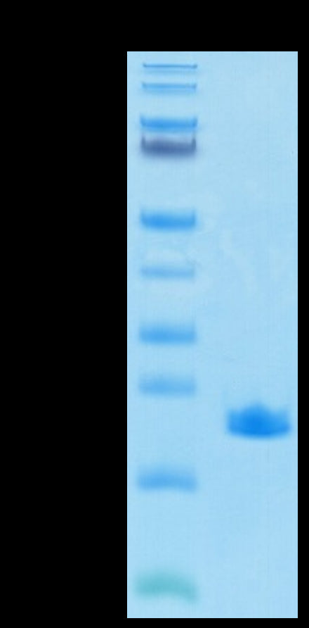 SARS-COV-2 NP CTD Domain on Tris-Bis PAGE under reduced condition. The purity is greater than 95%.Recombinant SARS-COV-2 Nucleocapsid Protein CTD Domain Protein