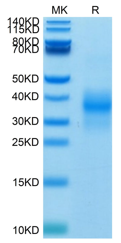 Biotinylated Human NKG2D on Tris-Bis PAGE under reduced condition. The purity is greater than 95%.Biotinylated Human NKG2D/CD314 Protein, Active
