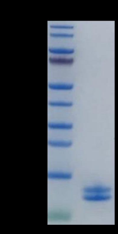 Human Calprotectin (S100A8&S100A9) on Tris-Bis PAGE under reduced condition. The purity is greater than 95%.Recombinant Human Calprotectin (S100A8&S100A9) Protein