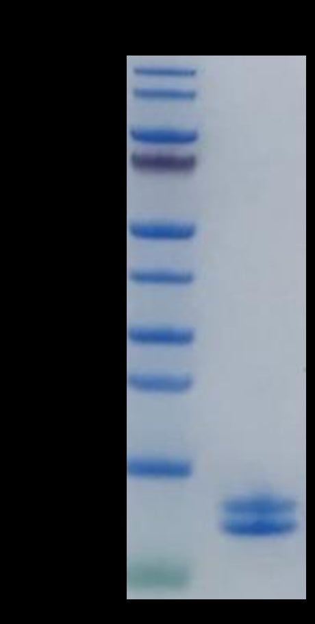 Human Calprotectin (S100A8&S100A9) on Tris-Bis PAGE under reduced condition. The purity is greater than 95%.Recombinant Human Calprotectin (S100A8&S100A9) Protein