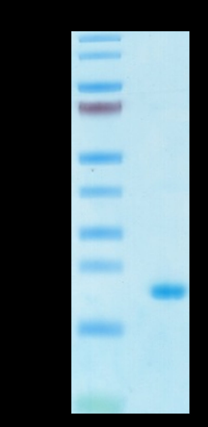 Human IL-10 on Tris-Bis PAGE under reduced condition. The purity is greater than 95%.Recombinant Human IL-10 Protein, Active