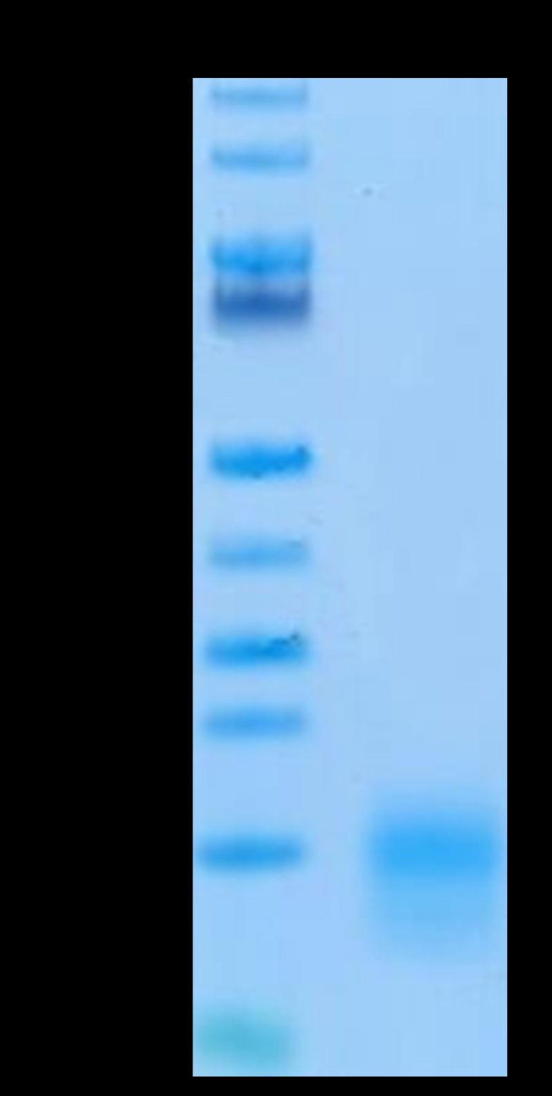 Biotinylated Mouse BCMA on Tris-Bis PAGE under reduced condition. The purity is greater than 95%.Biotinylated Mouse BCMA/TNFRSF17 Protein, Active