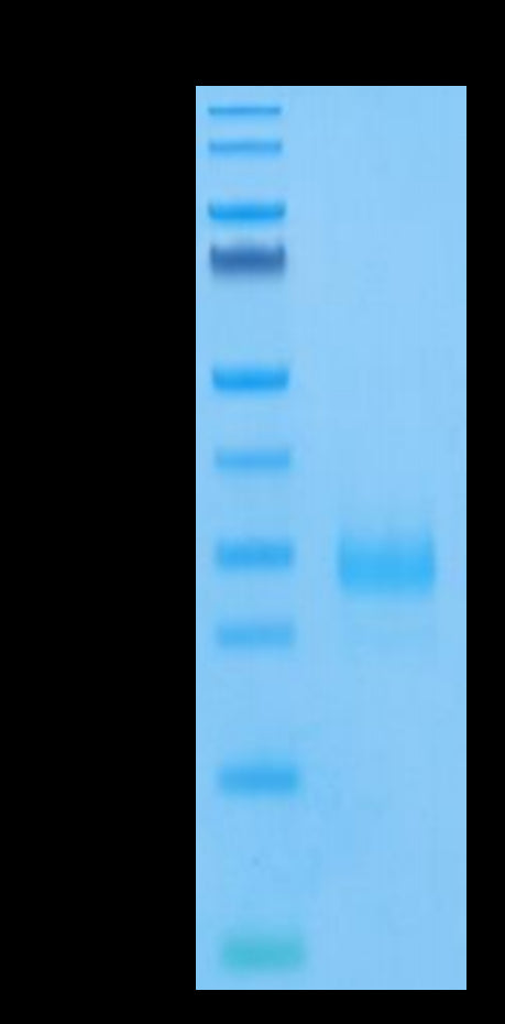 Human CD160 on Tris-Bis PAGE under reduced condition. The purity is greater than 95%.