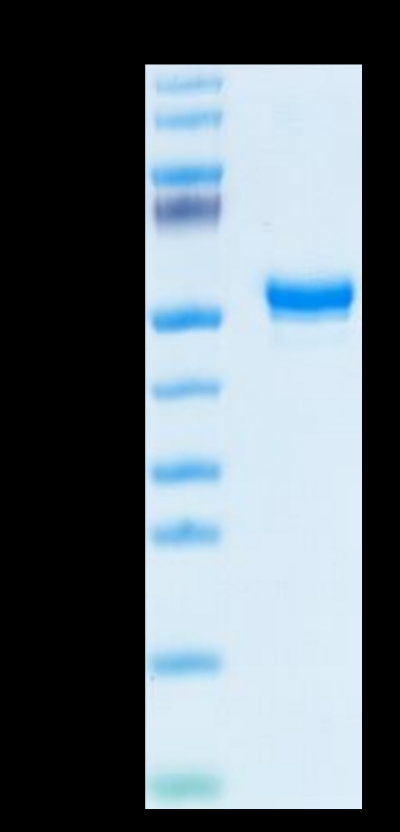 Human CD160 on Tris-Bis PAGE under reduced condition. The purity is greater than 95%.Recombinant Human CD160 Protein, Active